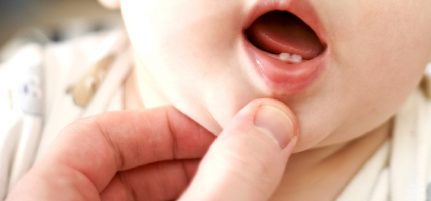 poussées dentaires de bébé